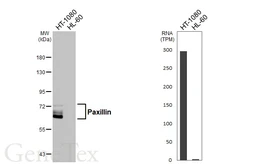 Anti-Paxillin antibody [HL4819] used in Western Blot (WB). GTX644831