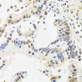 Anti-SUZ12 antibody used in IHC (Paraffin sections) (IHC-P). GTX64485