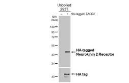 Anti-Neurokinin 2 Receptor antibody [HL4859] used in Western Blot (WB). GTX644922