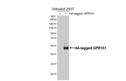Anti-GPR151 antibody [HL4860] used in Western Blot (WB). GTX644923