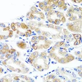 Anti-SAP97 antibody used in IHC (Paraffin sections) (IHC-P). GTX64496