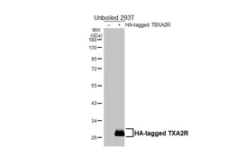 Anti-TXA2R antibody [HL4935] used in Western Blot (WB). GTX645008