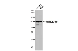 Anti-ARHGEF18 antibody [HL4995] used in Western Blot (WB). GTX645088
