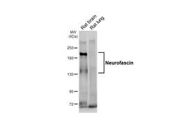 Anti-Neurofascin antibody [GT316] used in Western Blot (WB). GTX645191