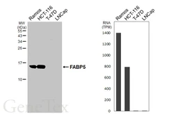 Anti-FABP5 antibody [HL5052] used in Western Blot (WB). GTX645222