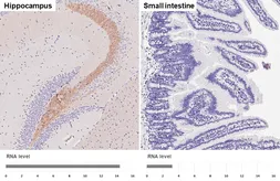 Anti-BACE1 antibody [HL5066] used in IHC (Paraffin sections) (IHC-P). GTX645256