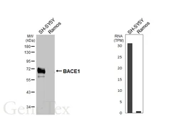 Anti-BACE1 antibody [HL5067] used in Western Blot (WB). GTX645257