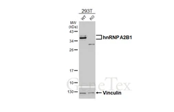 Anti-hnRNP A2B1 antibody [HL5249] used in Western Blot (WB). GTX645505