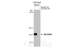 Anti-SLC4A4 antibody [HL5250] used in Western Blot (WB). GTX645506
