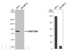 Anti-HSD17B4 antibody [HL5299] used in Western Blot (WB). GTX645764