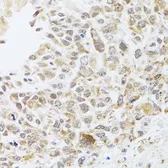 Anti-RNase L antibody used in IHC (Paraffin sections) (IHC-P). GTX64577
