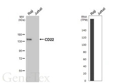 Anti-CD22 antibody [HL5322] used in Western Blot (WB). GTX645787
