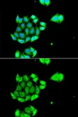 Anti-Rad51D antibody used in Immunocytochemistry/ Immunofluorescence (ICC/IF). GTX64591