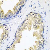 Anti-HAI-2 antibody used in IHC (Paraffin sections) (IHC-P). GTX64596