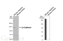 Anti-LI-Cadherin antibody [HL5395] used in Western Blot (WB). GTX645963