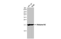 Anti-Histone H3 antibody [HL5419] used in Western Blot (WB). GTX645987