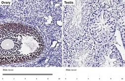 Anti-Inhibin beta A antibody [HL5443] used in IHC (Paraffin sections) (IHC-P). GTX646085