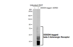 Anti-beta 3 Adrenergic Receptor antibody [HL5445] used in Western Blot (WB). GTX646087
