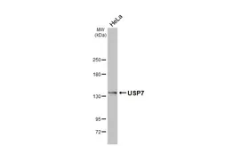 Anti-USP7 antibody [HL5485] used in Western Blot (WB). GTX646149