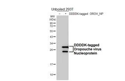 Anti-Oropouche virus Nucleoprotein antibody [HL5558] used in Western Blot (WB). GTX646232