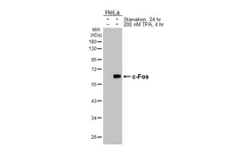 Anti-c-Fos antibody [HL5568] used in Western Blot (WB). GTX646242