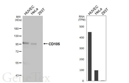 Anti-CD105 antibody [HL5572] used in Western Blot (WB). GTX646254