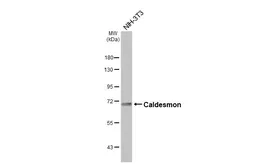 Anti-Caldesmon antibody [HL5575] used in Western Blot (WB). GTX646257