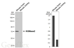 Anti-NSMase2 antibody [HL5589] used in Western Blot (WB). GTX646271