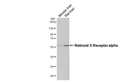 Anti-Retinoid X Receptor alpha antibody [HL5602] used in Western Blot (WB). GTX646284
