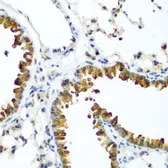 Anti-TAZ antibody used in IHC (Paraffin sections) (IHC-P). GTX64636