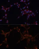 Anti-ALDH6A1 antibody used in Immunocytochemistry/ Immunofluorescence (ICC/IF). GTX64647