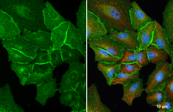 Anti-xCT / SLC7A11 antibody [HL5661] used in Immunocytochemistry/ Immunofluorescence (ICC/IF). GTX646470