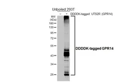 Anti-GPR14 antibody [HL5695] used in Western Blot (WB). GTX646526