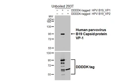 Anti-Human parvovirus B19 VP1 antibody [HL5713] used in Western Blot (WB). GTX646544