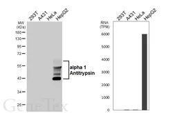 Anti-alpha 1 Antitrypsin antibody [HL5724] used in Western Blot (WB). GTX646675