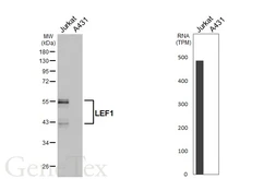 Anti-LEF1 antibody [HL5728] used in Western Blot (WB). GTX646679