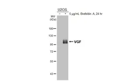Anti-VGF antibody [HL5755] used in Western Blot (WB). GTX646706