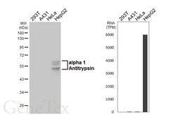 Anti-alpha 1 Antitrypsin antibody [HL5758] used in Western Blot (WB). GTX646709