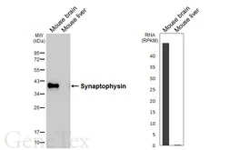 Anti-Synaptophysin antibody [HL5771] used in Western Blot (WB). GTX646842