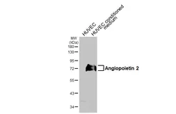 Anti-Angiopoietin 2 antibody [HL5774] used in Western Blot (WB). GTX646845
