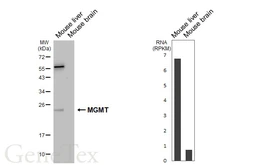 Anti-MGMT antibody [HL5779] used in Western Blot (WB). GTX646850