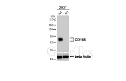 Anti-CD155 antibody [HL5788] used in Western Blot (WB). GTX646859