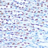 Anti-DMT1 antibody used in IHC (Paraffin sections) (IHC-P). GTX64686