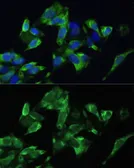 Anti-PMEPA1 antibody used in Immunocytochemistry/ Immunofluorescence (ICC/IF). GTX64694