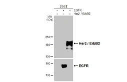 Anti-Her2 / ErbB2 antibody [HL5814] used in Western Blot (WB). GTX647132