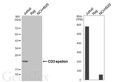 Anti-CD3 epsilon antibody [HL5848] used in Western Blot (WB). GTX647166