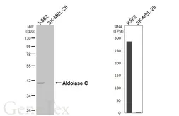 Anti-Aldolase C antibody [HL5849] used in Western Blot (WB). GTX647167