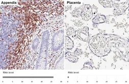 Anti-CD2 antibody [HL5859] used in IHC (Paraffin sections) (IHC-P). GTX647183
