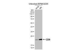 Anti-CD9 antibody [HL5888] used in Western Blot (WB). GTX647212