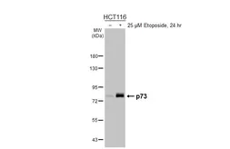 Anti-p73 antibody [HL5895] used in Western Blot (WB). GTX647219
